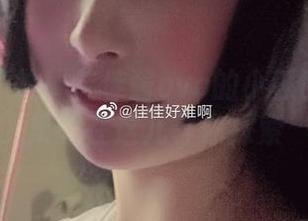 无圣光不怕！佳佳酱ovo的小熊比基尼合集就在这儿等你探索